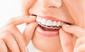 Eine Person mit einem strahlenden Lächeln setzt sich einen Aligner ein danke der Zahnzusatzversicherung des Münchener Vereins