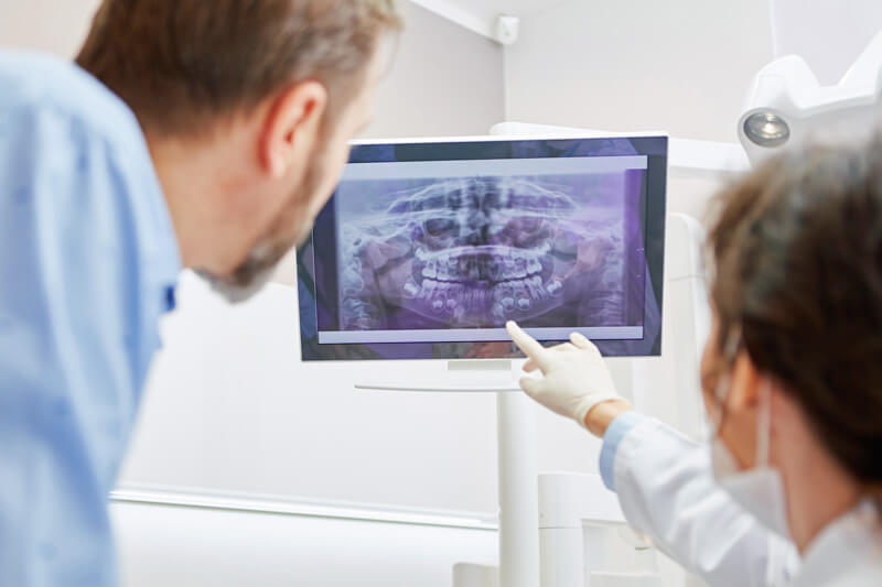 Ratgeber Karies - Zahnarzt erklärt einem Patient Röntgenaufnahme