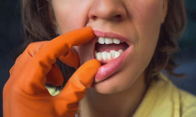 Frau mit Handschuhen zeigt ihre schiefen Zähne.