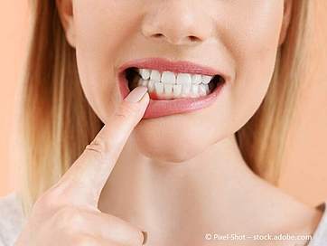 Was tun bei Zahnfleischentzündung? Welche Hausmittel helfen und wie ist die Behandlung?