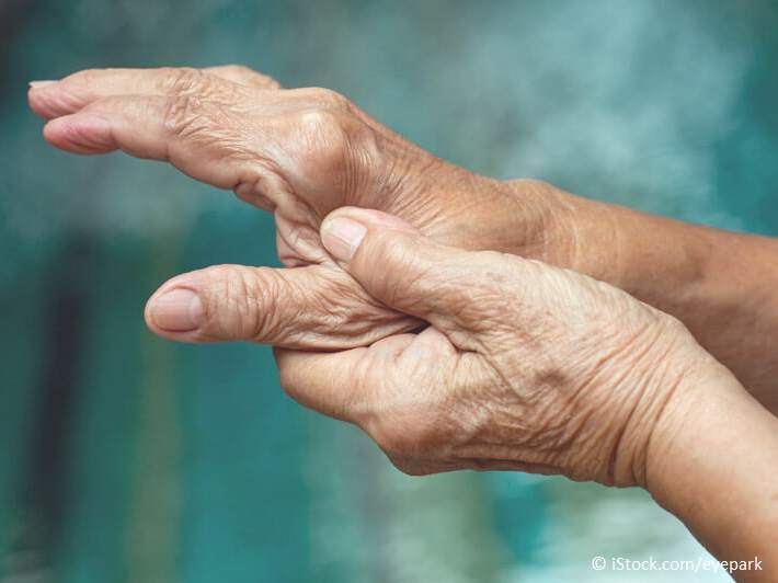 Rheuma und Gelenkschmerzen durch Zähne- Ratgeber Zahngesundheit - Münchener Verein