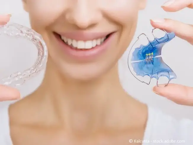 Retainer - Kosten, Arten, Vor- und Nachteile - Ratgeber Zahngesundheit - Münchener Verein