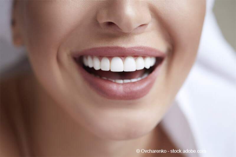 Kann man von Natur aus schlechte Zähne haben?