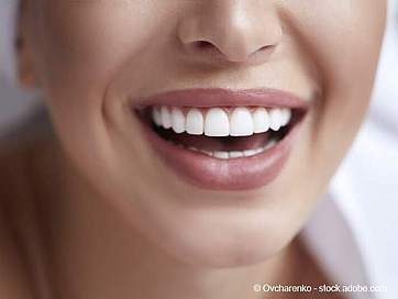 Das Geheimnis schöner weißer Zähne