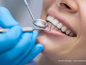 Zahnvorsorge: Wie oft, Ablauf und Kosten