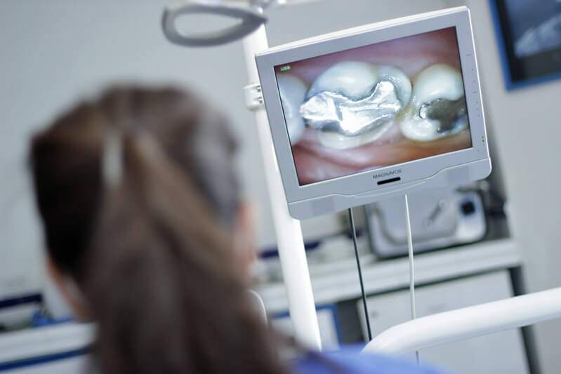 Dringender Zahnarztbesuch wenn Amalgamfüllung defekt- Ratgeber Zahngesundheit - Münchener Verein