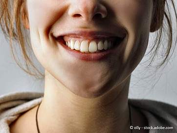 Zahnfleischrückgang was tun? Ursachen & Behandlung