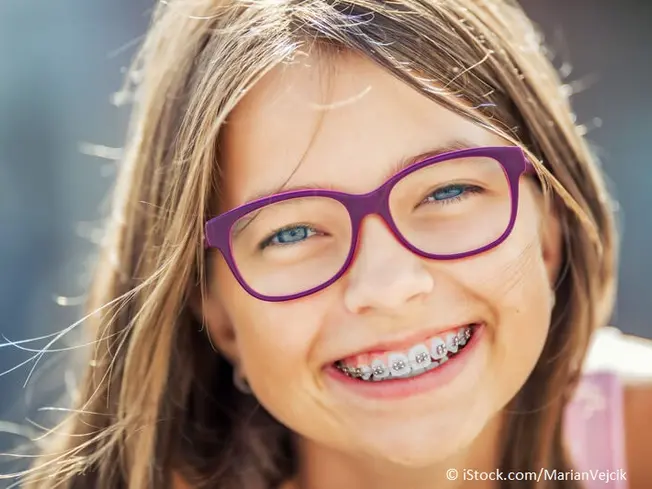 Kieferorthopädie bei Kindern - Ratgeber Zahngesundheit - Münchener Verein