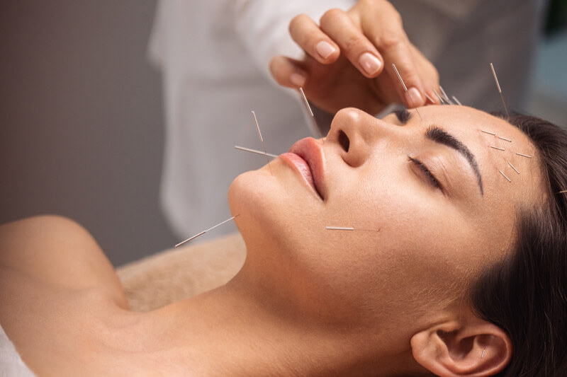 Akupunktur ist eine Säule der Traditionellen Chinesischen Medizin - Ratgeber Gesundheit - Münchener Verein