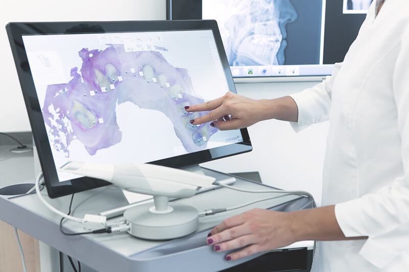 Zahnzusatzversicherung Testsieger: Digitaler Intraoralscanner liefert hochauflösende und präzise 3D-Aufnahme eines Gebisses.