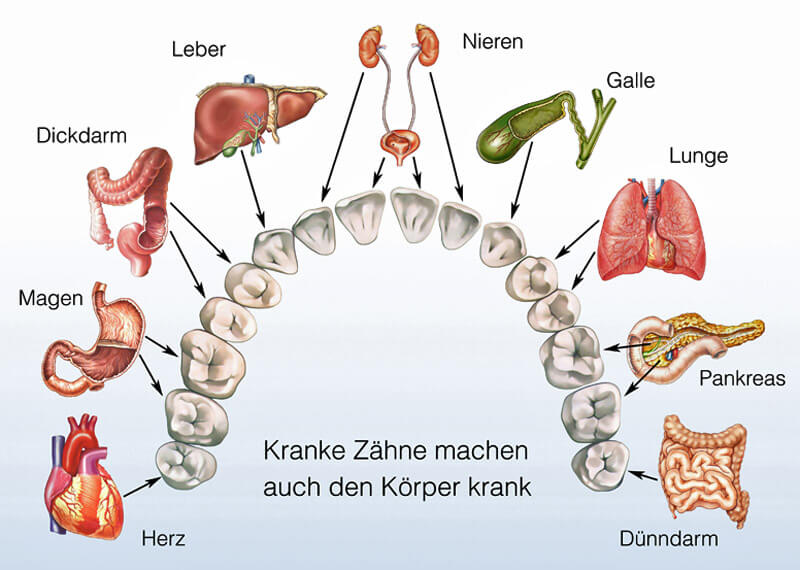 Kranke Zähne: Wechselbeziehung mit dem Körper - Ratgeber Zahngesundheit - Münchener Verein