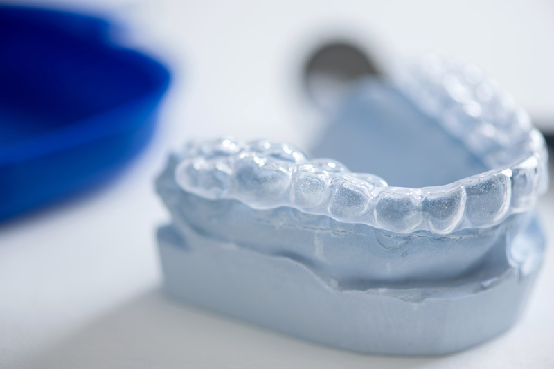 Schmerzempfindlichen Zähnen, die durch Zähneknirschen entstehen, kann mit einer Aufbissschiene entgegengewirkt werden.
