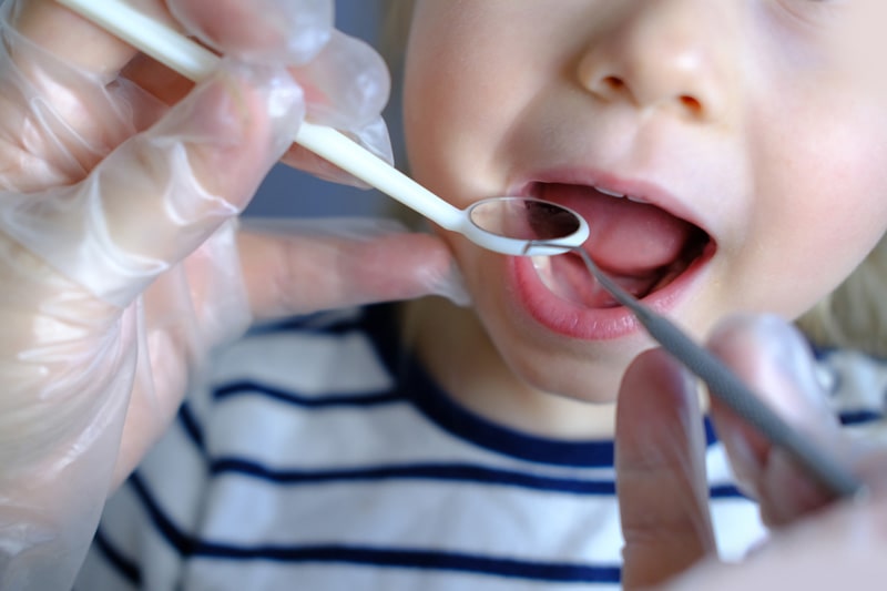 Rechtzeitiges Handeln ist besonders bei Kleinkindern wichtig, um Zahnerkrankungen rechtzeitig zu behandeln.