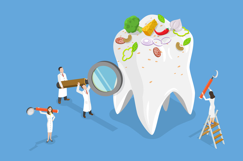 Durch das Ansammeln von Nahrungsresten und Bakterien kann Zahnstein entstehen.